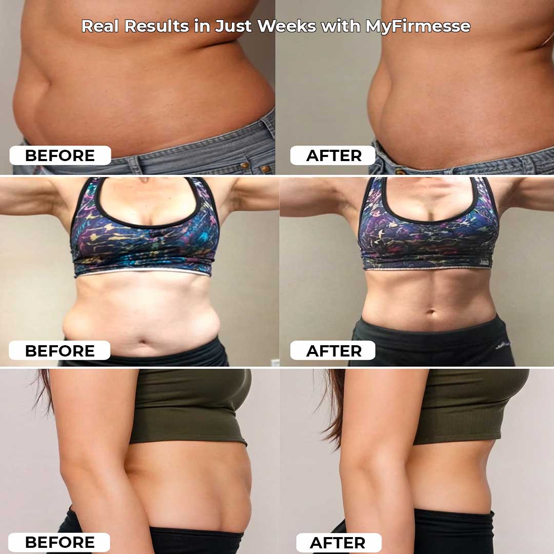 Pilates Reformer Set