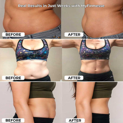 Pilates Reformer Set